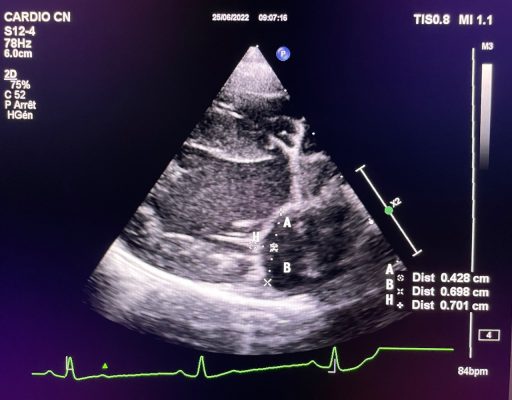 echocardio 2